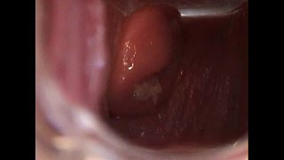 Avy Aperto Pussy cum Speculum